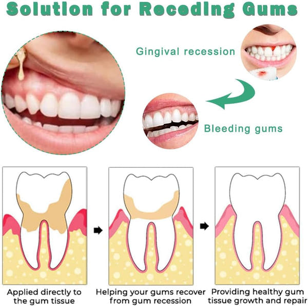 Gum Revival Drops-Återställ ditt tandkött & få ett friskare leende naturligt